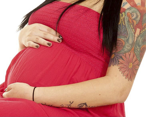 میکروپیگمنتیشن در دوران بارداری و شیردهی؛ بله یا خیر؟