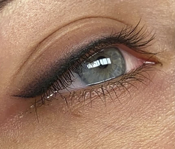 آیا کانتور چشم دائمی خطر دارد؟ بررسی علمی و تجربی