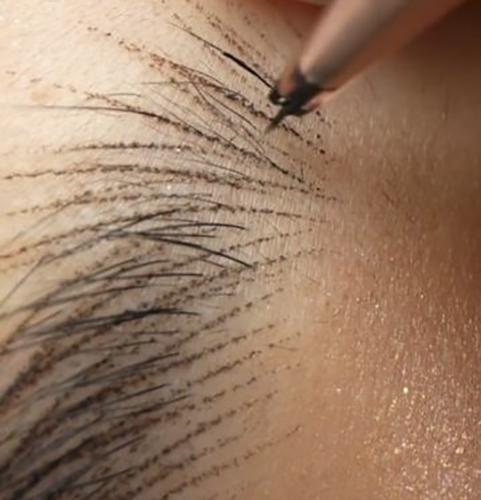 ۱۰ سوال پرتکرار درباره میکروپیگمنتیشن که باید بدانید