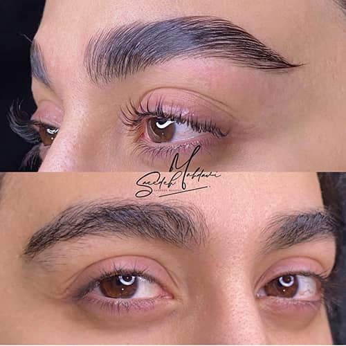 لیفت مژه و ابرو