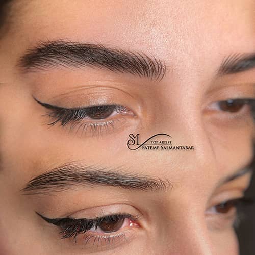 هیراستروک - کد ۱۰۷