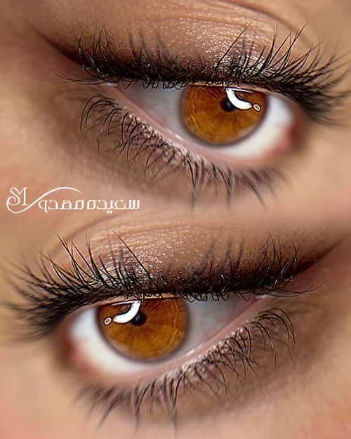 شیدینگ چشم -۱۰۰