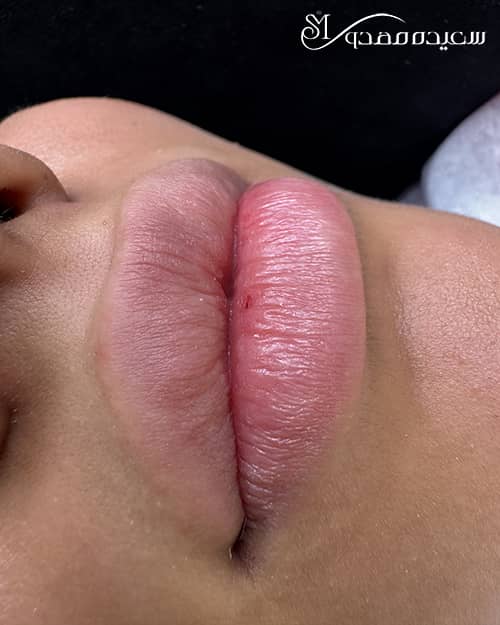 شیدینگ لب- ۱۰۰