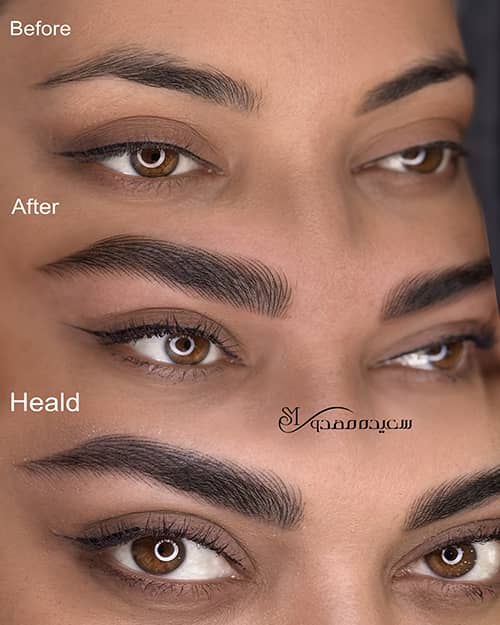 هیراستروک ابرو