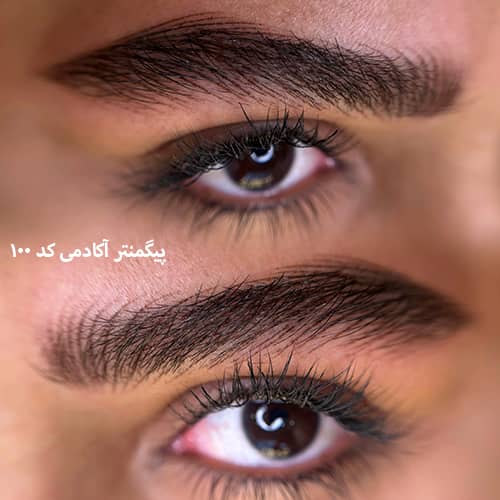 هیر استروک ۱۰۰