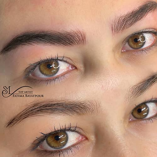 هیر استروک - کد ۱۰۴