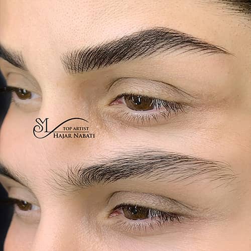 هیراستروک - کد ۱۰۵