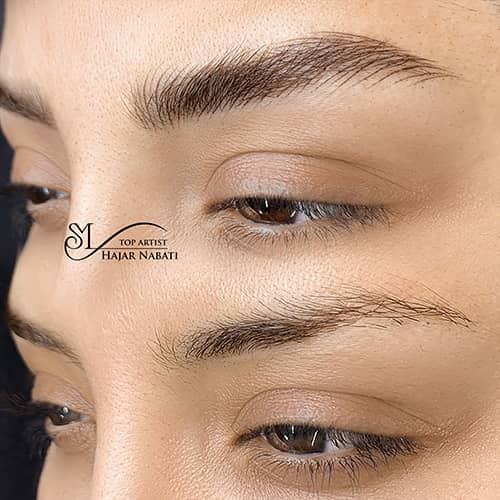 هیراستروک - کد ۱۰۵