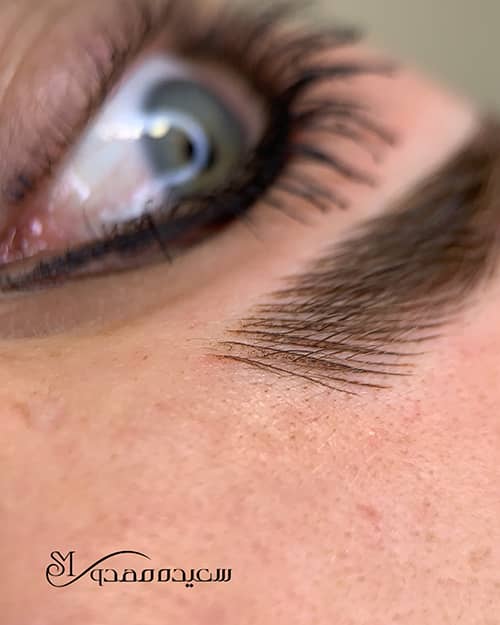 میکروبلیدینگ ابرو