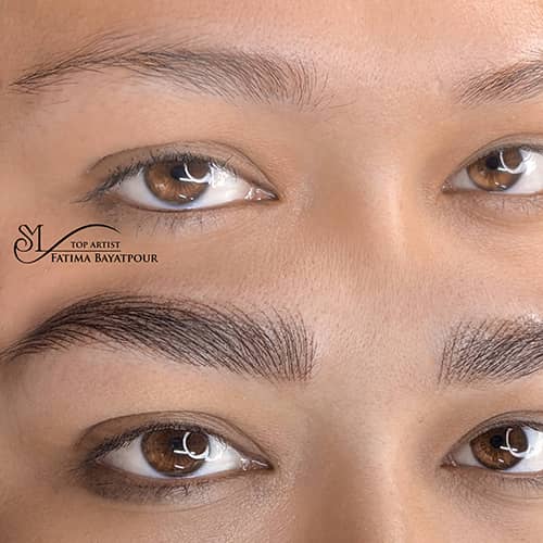 هیراستروک - کد ۱۰۴