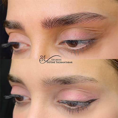 هیراستروک - کد ۱۰۷