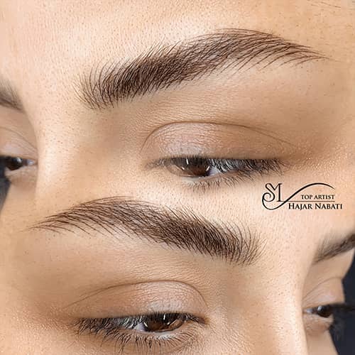 هیراستروک - کد ۱۰۵